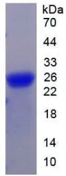 Human Gremlin 1 protein, His tag (active). GTX00210-pro