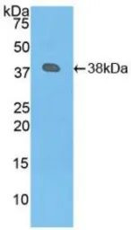 Human Plasminogen protein, His tag. GTX00216-pro