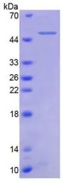 Human TNF Receptor II protein, His tag (active). GTX00235-pro