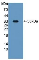 Human PAPP A protein, His tag. GTX00254-pro