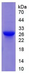 Rat GSTM1 protein, His tag. GTX00356-pro