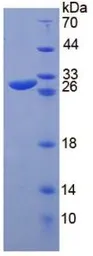 Rat CHI3L1 protein, His tag (active). GTX00364-pro