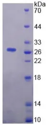 Human Neuregulin-1 protein, His tag (active). GTX00417-pro