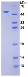 Human EPO protein, His and GST tag (active). GTX00422-pro