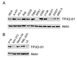 Anti-TPX2 antibody [TPX2-01] used in Western Blot (WB). GTX00510
