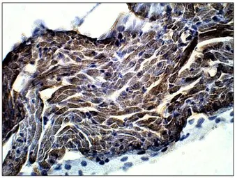 Anti-IL17 Receptor beta antibody used in IHC (Paraffin sections) (IHC-P). GTX00640