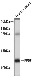 Anti-NAP2 antibody used in Western Blot (WB). GTX00654