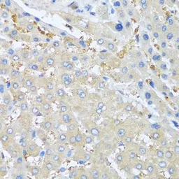 Anti-NAP2 antibody used in IHC (Paraffin sections) (IHC-P). GTX00654