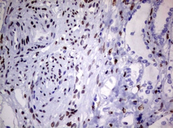 Anti-ZEB2 antibody [OTI1E12] used in IHC (Paraffin sections) (IHC-P). GTX00672