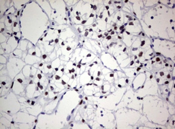 Anti-ZEB2 antibody [OTI1E12] used in IHC (Paraffin sections) (IHC-P). GTX00672