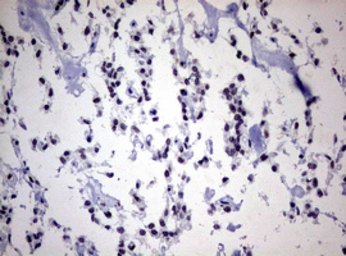 Anti-ZEB2 antibody [OTI1E12] used in IHC (Paraffin sections) (IHC-P). GTX00672