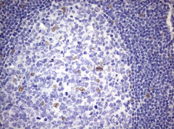 Anti-ZEB2 antibody [OTI1E12] used in IHC (Paraffin sections) (IHC-P). GTX00672
