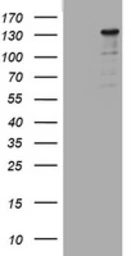 Anti-ZEB2 antibody [OTI1E12] used in Western Blot (WB). GTX00672