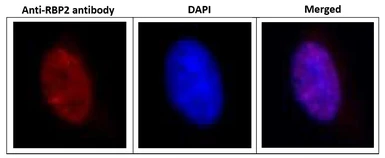 Anti-KDM5A / Jarid1A / RBBP2 antibody [18E8] used in Immunocytochemistry/ Immunofluorescence (ICC/IF). GTX00688