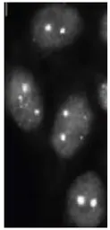 Anti-SUMO2 + SUMO3 antibody [3H12] used in Immunocytochemistry/ Immunofluorescence (ICC/IF). GTX00699