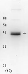 Anti-XPA antibody [5F12] used in Western Blot (WB). GTX00704