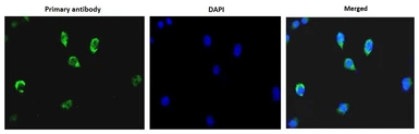 Anti-DNA polymerase beta antibody used in Immunocytochemistry/ Immunofluorescence (ICC/IF). GTX00722