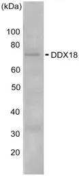 Anti-DDX18 antibody used in Western Blot (WB). GTX00725
