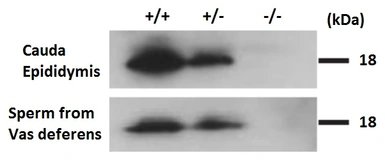 Anti-CD52 antibody used in Western Blot (WB). GTX00743