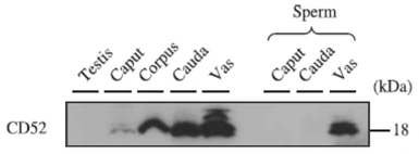 Anti-CD52 antibody used in Western Blot (WB). GTX00743