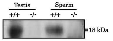 Anti-PMIS2 antibody used in Western Blot (WB). GTX00748