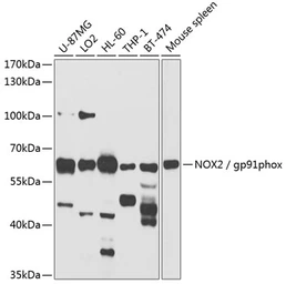 Anti-NOX2 / gp91phox antibody used in Western Blot (WB). GTX00785