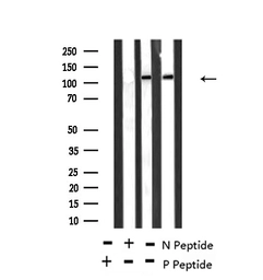 Anti-TIE2 (phospho Ser1119) antibody used in Western Blot (WB). GTX00793