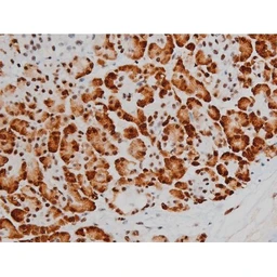 Anti-ATF2 (phospho Thr69) antibody used in IHC (Paraffin sections) (IHC-P). GTX00805
