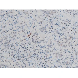 Anti-ATF2 (phospho Thr69) antibody used in IHC (Paraffin sections) (IHC-P). GTX00805