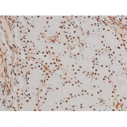 Anti-ATF2 (phospho Thr69) antibody used in IHC (Paraffin sections) (IHC-P). GTX00805