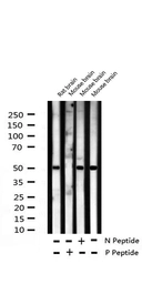 Anti-ATF2 (phospho Thr69) antibody used in Western Blot (WB). GTX00805