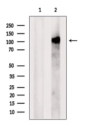 Anti-PACS2 antibody used in Western Blot (WB). GTX00808