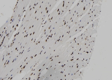 Anti-RUNX2 (phospho Ser28) antibody used in IHC (Paraffin sections) (IHC-P). GTX00811