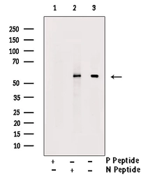 Anti-RUNX2 (phospho Ser340) antibody used in Western Blot (WB). GTX00812