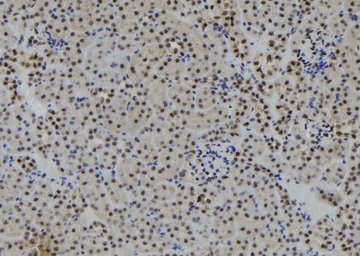 Anti-RUNX2 (phospho Ser275) antibody used in IHC (Paraffin sections) (IHC-P). GTX00813