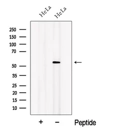 Anti-OSBPL2 antibody used in Western Blot (WB). GTX00814