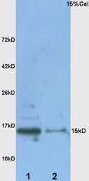 Anti-Metallothionein antibody used in Western Blot (WB). GTX00824