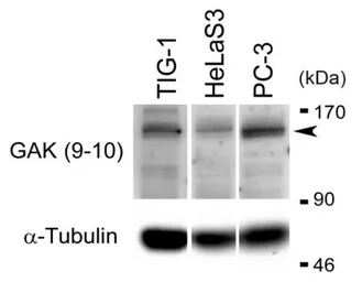 Anti-GAK antibody [9-10] used in Western Blot (WB). GTX00874