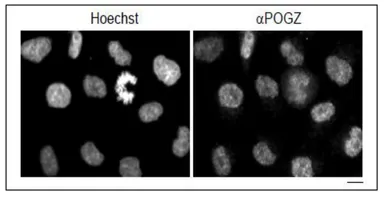 Anti-Pogz antibody used in Immunocytochemistry/ Immunofluorescence (ICC/IF). GTX00892