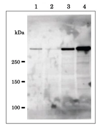 Anti-EDD antibody used in Western Blot (WB). GTX00902