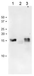 Anti-Ferredoxin 1 + Ferredoxin 2 antibody used in Western Blot (WB). GTX00911