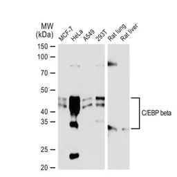 Anti-C/EBP beta antibody [GT1145] used in Western Blot (WB). GTX00915