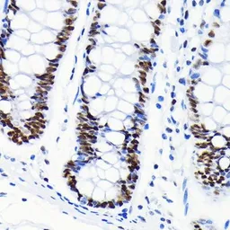 Anti-Chk2 antibody [GT1148] used in IHC (Paraffin sections) (IHC-P). GTX00927