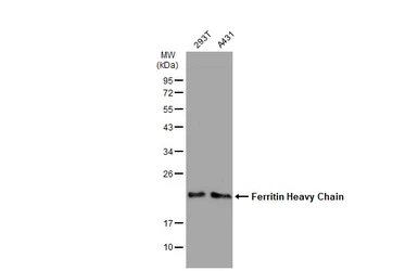 Anti-Ferritin Heavy Chain antibody [GT1149] used in Western Blot (WB). GTX00928