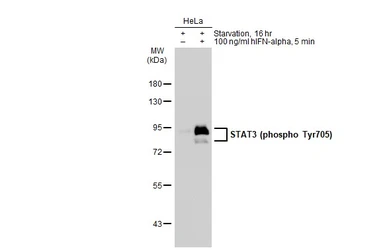 Anti-STAT3 (phospho Tyr705) antibody [GT1204] used in Western Blot (WB). GTX00966