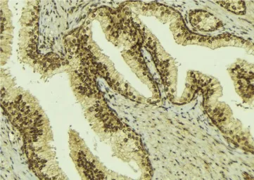 Anti-BCOR antibody used in IHC (Paraffin sections) (IHC-P). GTX01027