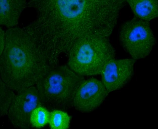 Anti-Cullin 4a antibody [JU07-33] used in Immunocytochemistry/ Immunofluorescence (ICC/IF). GTX01050