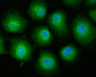 Anti-Cullin 4a antibody [JU07-33] used in Immunocytochemistry/ Immunofluorescence (ICC/IF). GTX01050