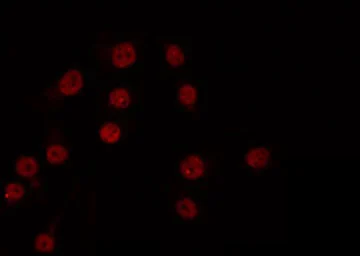 Anti-XRN2 antibody used in Immunocytochemistry/ Immunofluorescence (ICC/IF). GTX01072
