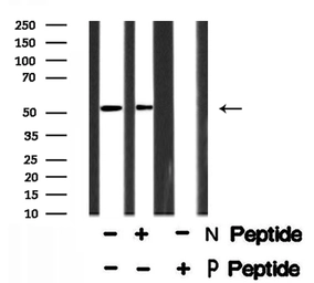 Anti-Steroidogenic Factor 1 (phospho Ser203) antibody used in Western Blot (WB). GTX01075
